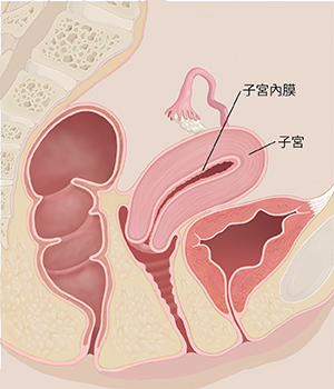 女性骨盆側視圖剖面圖，顯示子宮和子宮內壁。