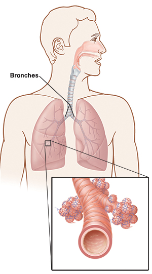 Bronches