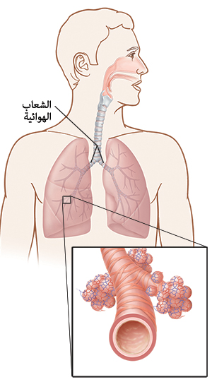 شكل توضيحي يبين موضع الرئتين والشعب الهوائية، مع منظر مقرّب لشعبة هوائية وحويصلة هوائية.