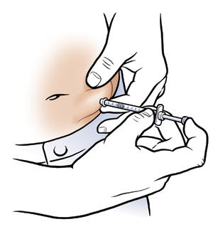 Primer plano de un abdomen en el que se ven unas manos aplicando una inyección subcutánea en el tejido graso.