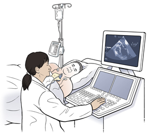 Hombre acostado de lado sobre una mesa de examen con cables de electrocardiograma en el pecho. Una técnica sostiene una sonda de ecografía sobre el pecho del hombre.