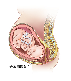子宮中胎兒側視圖,顯示厚而閉合的子宮頸。