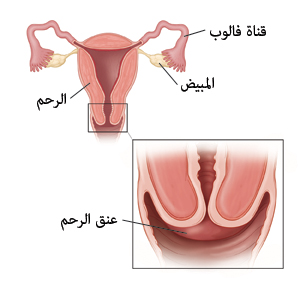 صورة تظهر مقطعًا عرضيًا للرحم، مع بيان قناة فالوب والمبيضين وصورة مقربة لعنق الرحم.