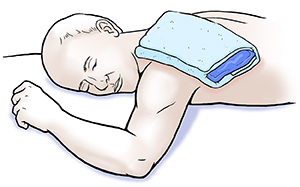 Lalaking nakadapa na may ice pack sa balikat.