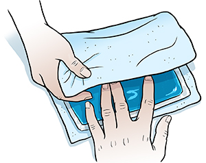 Malapitang kuha ng mga kamay ng babae na nagbabalot ng ice pack sa manipis na tuwalya.