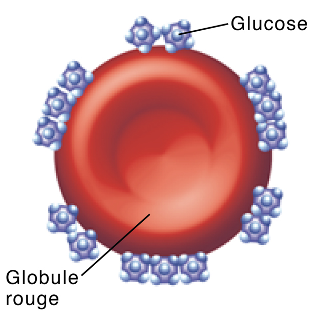 Globules rouges avec de nombreuses molécules de glucose fixées sur ceux-ci.