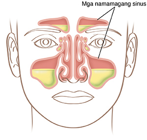 Ilustrasyon ng mukha na nagpapakita ng mga magang sinus.